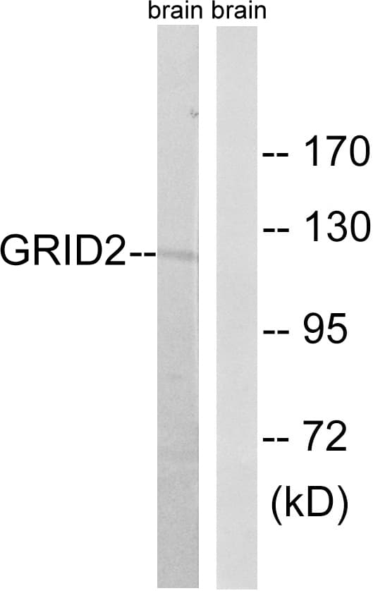 GRID2 Antibody (aa831-880)