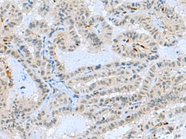 TCF19 / TCF-19 Antibody