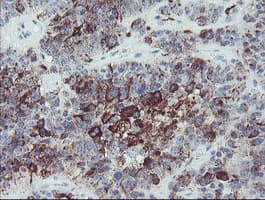 MYL7 Antibody (clone OTI7F2)