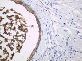 Monoclonal Mouse anti-Human WFDC2 / HE4 Antibody (clone OTI1E12, aa31-124, IHC, WB)