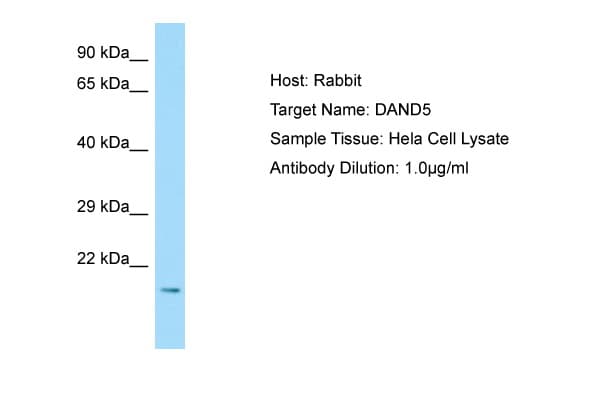 Polyclonal Rabbit anti-Human DAND5 Antibody (N-Terminus, WB)
