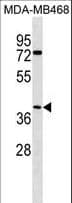 Polyclonal Rabbit anti-Human ABHD1 Antibody (aa289-315, WB)