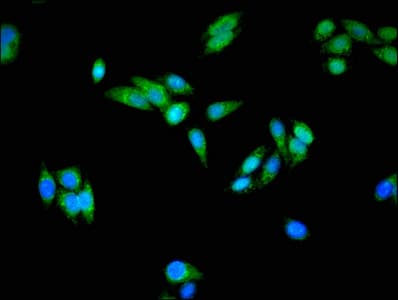 Polyclonal Rabbit anti-Human US01 / p115 Antibody (IHC, IF)