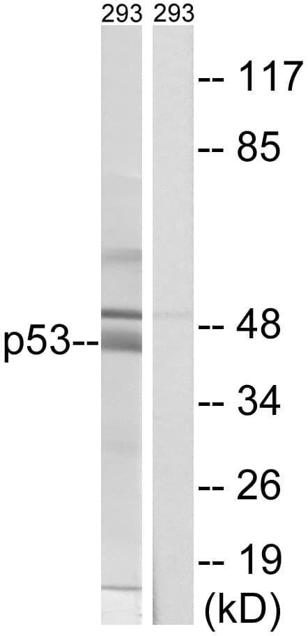 TP53 / p53 Antibody (aa336-385)
