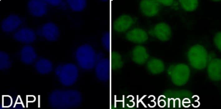 Polyclonal Rabbit anti-Human Histone H3 Antibody (Tri-Methyl-Lys36, IHC, IF, WB)
