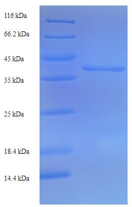 Bryonia dioica Bryodin I Protein (Recombinant His-SUMO)