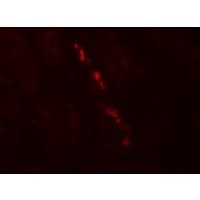 IHC-plus™ Polyclonal Rabbit anti-Human NPHS1 / Nephrin Antibody (IHC, IF, WB)