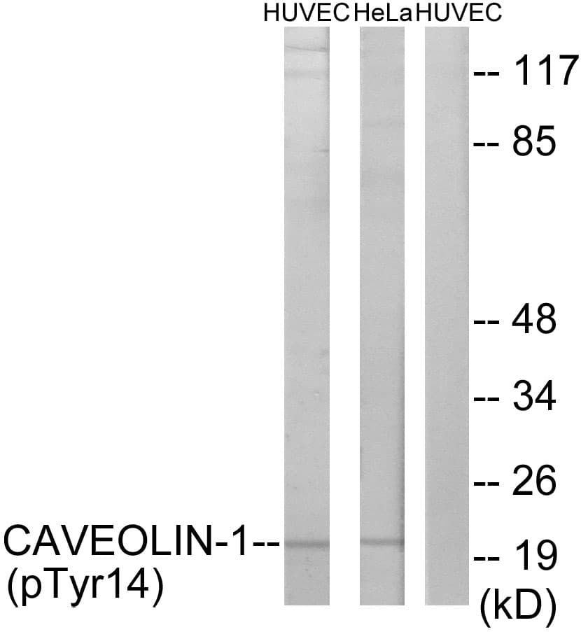 CAV1 / Caveolin 1 Antibody (phospho-Tyr14)
