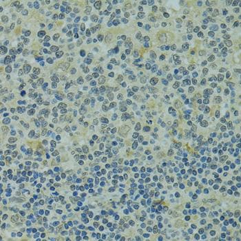 Polyclonal Rabbit anti-Human IVNS1ABP / NS1-BP Antibody (IHC)