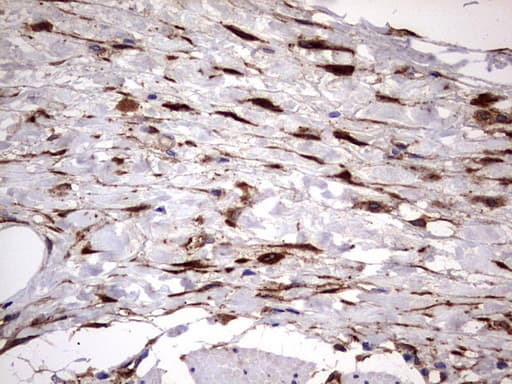 LGALS3 / Galectin 3 Antibody (clone OTI1C7)