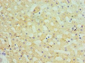 Polyclonal Rabbit anti-Human GATM / AGAT Antibody (aa124-423, IHC, WB)