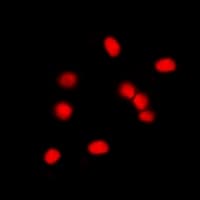 MDM2 Antibody (Internal)