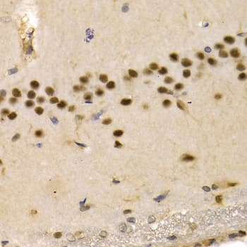 Polyclonal Rabbit anti-Human PTEN Antibody (IHC, WB)