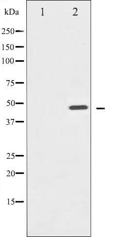 IKBKG / NEMO / IKK Gamma Antibody (phospho-Ser31)
