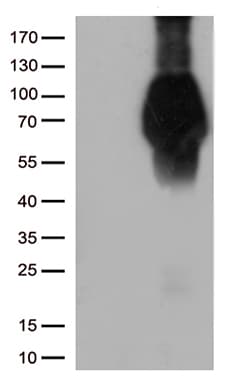 Monoclonal Mouse anti-Human FCGR1A / CD64 Antibody (clone UMAB74, IHC, WB)