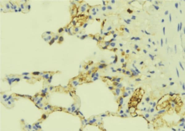 ECE-1 Antibody