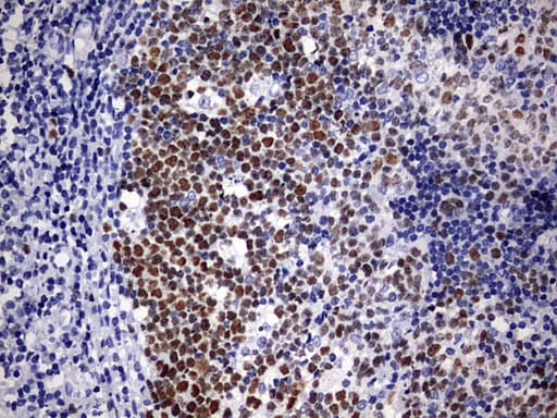 EZH2 Antibody (aa182-431, clone OTI2B10)