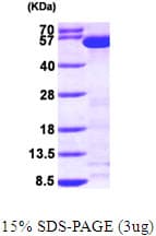 Human WARS Protein (Recombinant His)