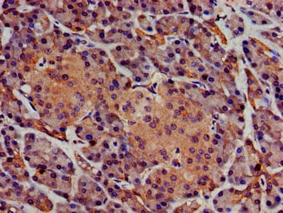 Polyclonal Rabbit anti-Human SGMS1 / TMEM23 Antibody (WB)