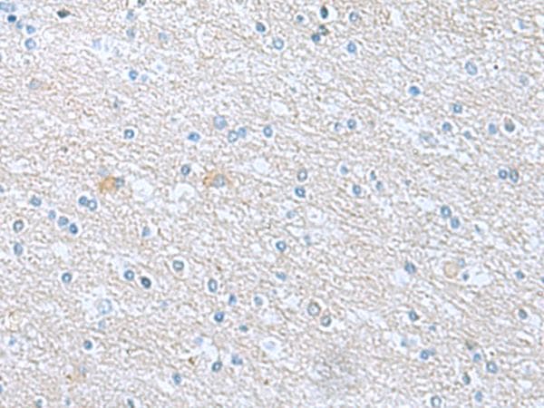Polyclonal Rabbit anti-Human TSTA3 / GDP-L-Fucose Synthase Antibody (IHC)