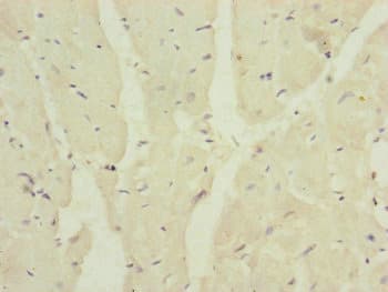 MRPS16 Antibody