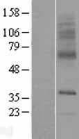 SLC29A3 / ENT3 Protein (Over-Expression Lysate Myc-DDK (Flag))