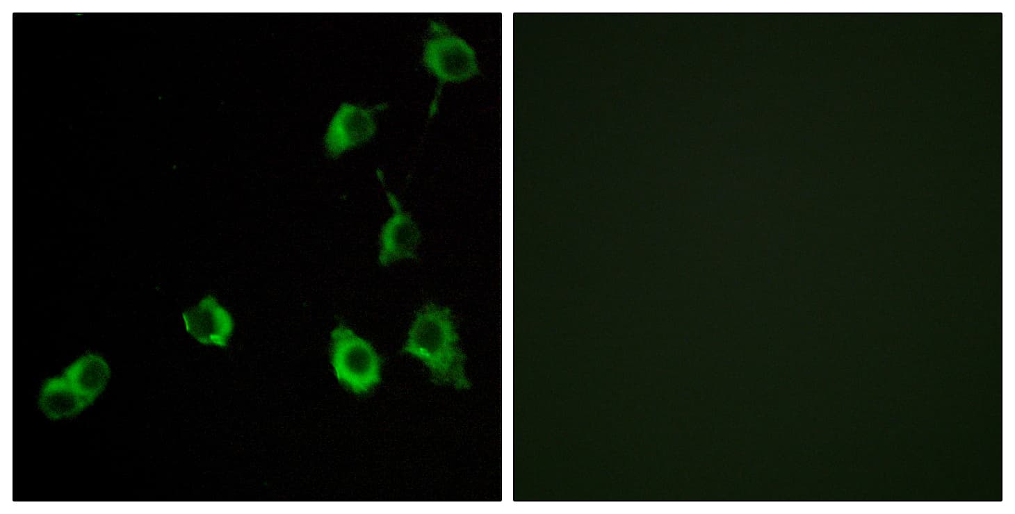 OR5B12 Antibody (aa195-244)