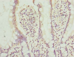 AGPAT2 Antibody