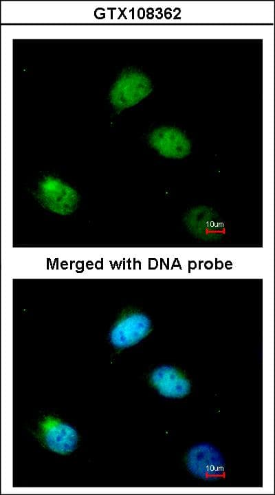 HNRNP-E2 / PCBP2 Antibody (aa302-365)