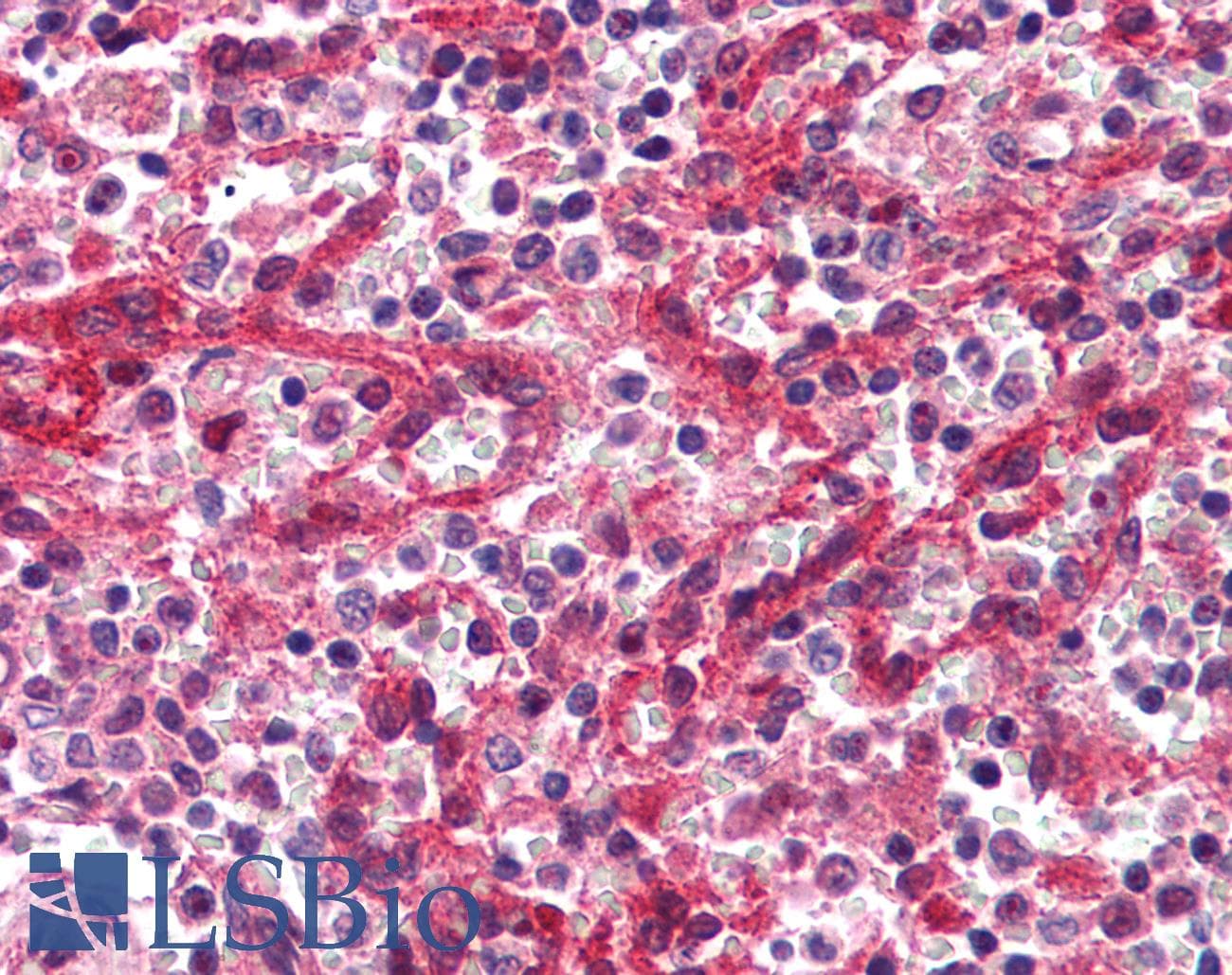 IHC-plus™ ACKR1 / DARC Antibody