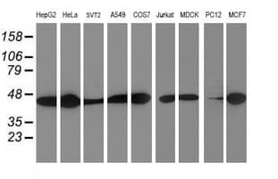 SMS / Spermine Synthase Antibody (clone OTI3C9)