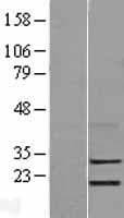 LYPD5 Protein (Over-Expression Lysate Myc-DDK (Flag))