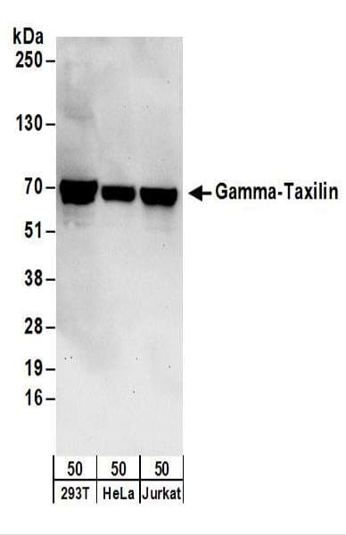 Polyclonal Rabbit anti-Human TXLNG Antibody (aa25-75, WB)