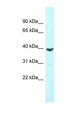 Polyclonal Rabbit anti-Human MTUS2 Antibody (aa266-315, WB)