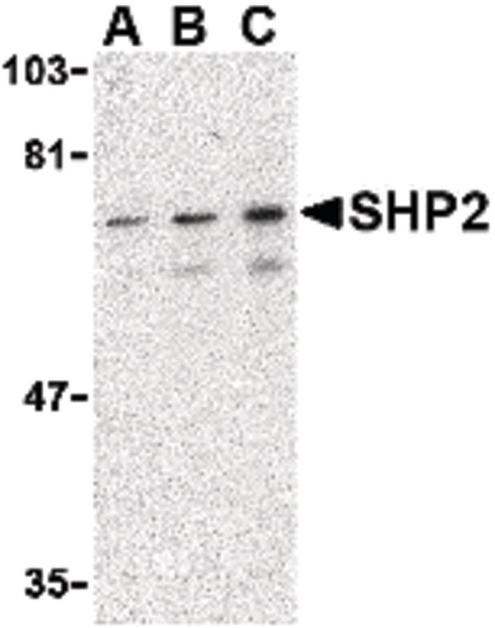 IHC-plus™ Polyclonal Rabbit anti-Human PTPN11 / SHP-2 / NS1 Antibody (IHC, WB)