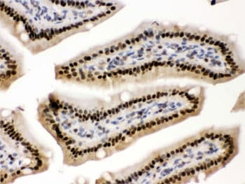 PRKAB2 / AMPK Beta 2 Antibody