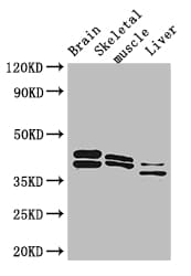 Polyclonal Rabbit anti-Human ALDOC / Aldolase C Antibody (IHC, IF, WB)