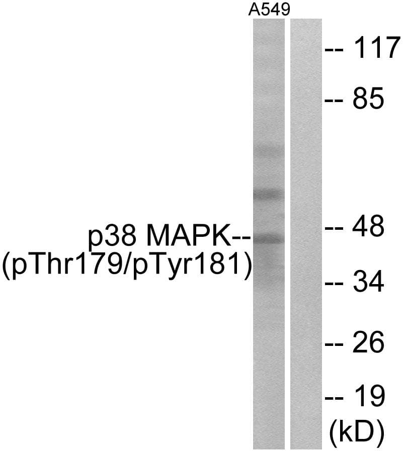 MAPK14 / p38 Antibody (phospho-Thr179+Tyr181)
