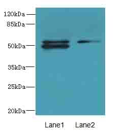 Polyclonal Rabbit anti-Human TRM6 / TRMT6 Antibody (IHC, WB)
