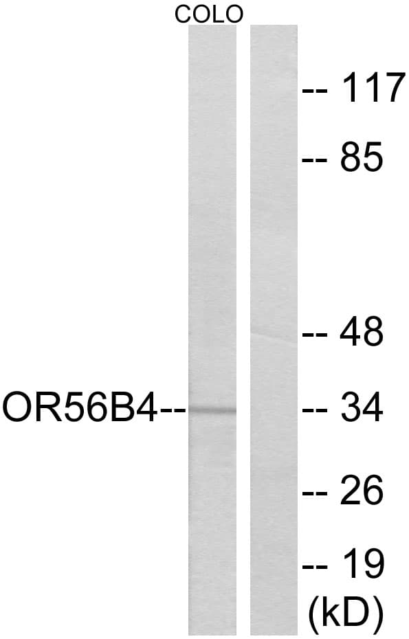 OR56B4 Antibody (aa241-290)
