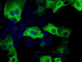 ERIC-1 / TACC3 Antibody (clone OTI1E11)