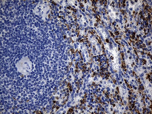 Monoclonal Mouse anti-Human TLR8 Antibody (clone OTI4F3, aa32-153, IHC, WB)