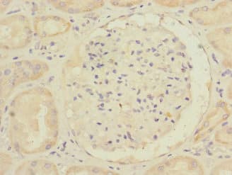 RHOBTB1 Antibody