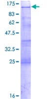 Human YTHDC1 Protein (Recombinant GST)
