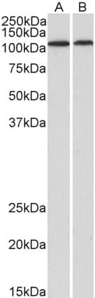 IHC-plus™ Polyclonal Goat anti-Human BMP1 Antibody (IHC, WB)
