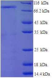 Human CD44 Protein (Recombinant 6His-SUMO, N-terminus)