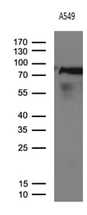 Monoclonal Mouse anti-Human R1 / RRM1 Antibody (clone OTI6G8, aa541-792, IHC, WB)