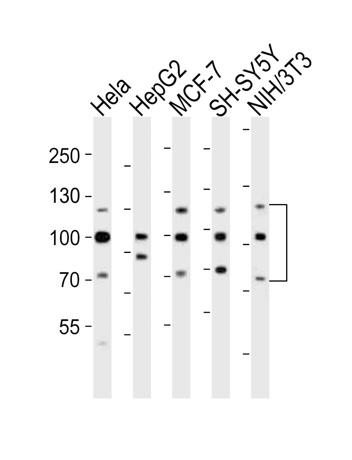 FGFR1 / FGF Receptor 1 Antibody (aa291-324)