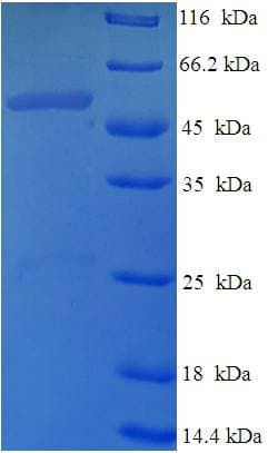Human DIMT1L Protein (Recombinant His-SUMO)