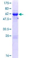 Human RWDD1 Protein (Recombinant GST)